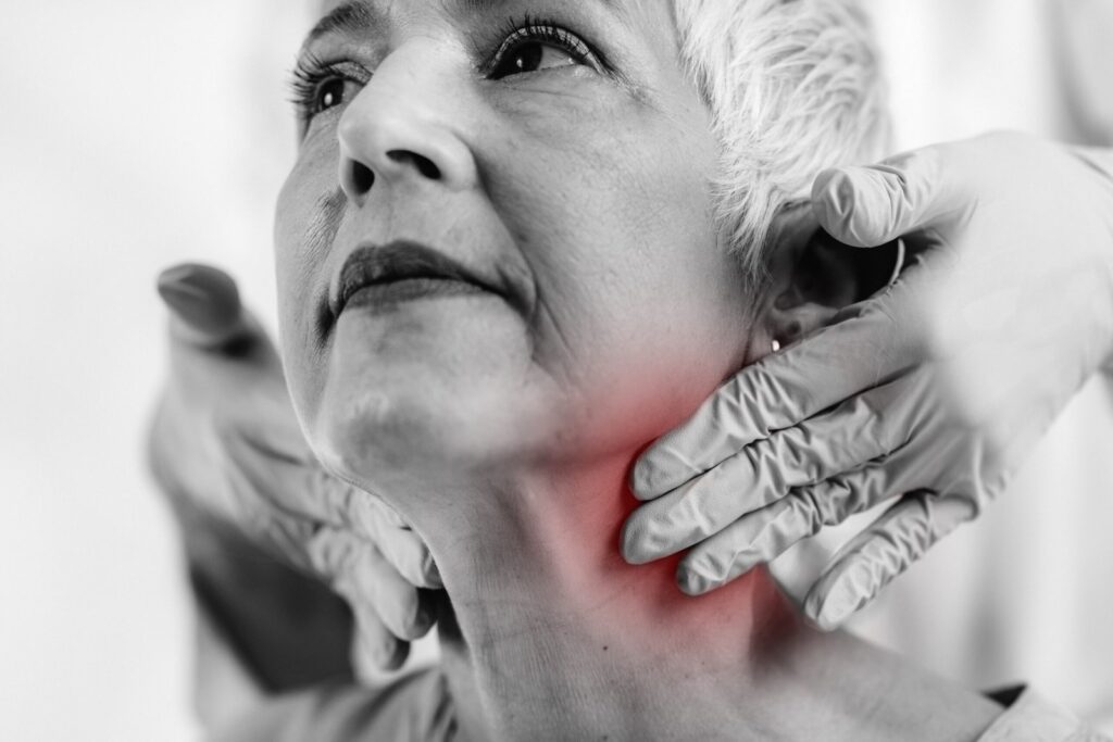 Paraganglioma jugular