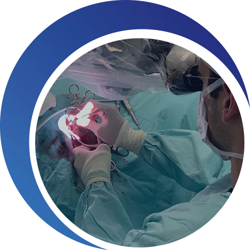 Timpanoplastia